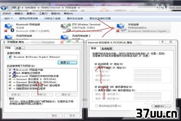 本地连接的ip设置