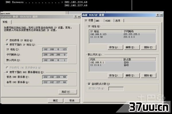 本地连接的ip设置